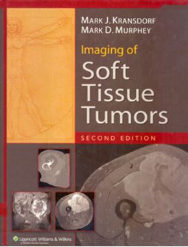 Imagem de IMAGING OF SOFT TISSUE TUMORS - 2ND ED