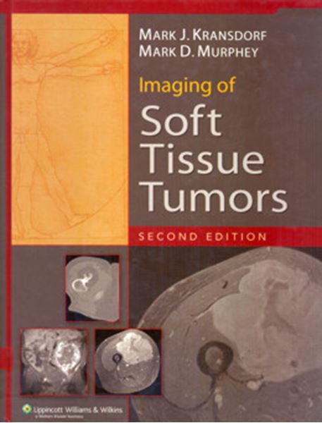 Picture of IMAGING OF SOFT TISSUE TUMORS - 2ND ED