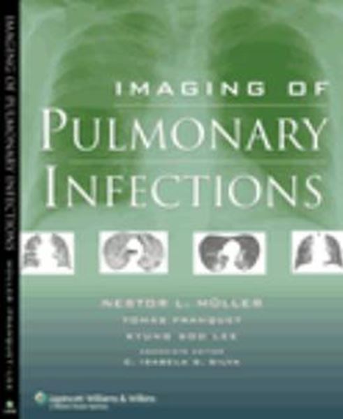 Picture of IMAGING OF PULMONARY INFECTIONS