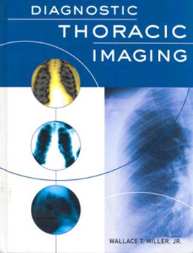 Imagem de DIAGNOSTIC THORACIC RADIOLOGY
