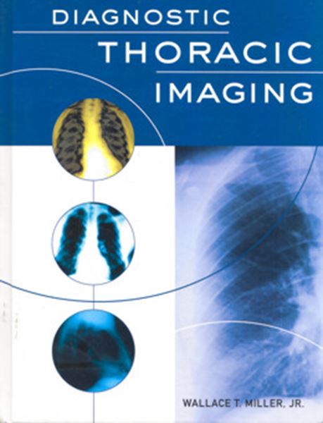 Picture of DIAGNOSTIC THORACIC RADIOLOGY