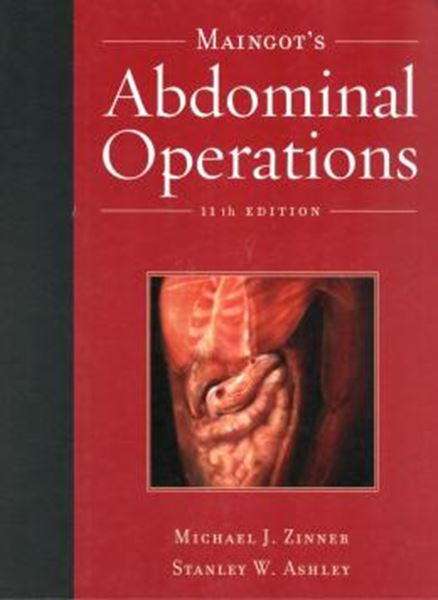 Picture of MAINGOT´S ABDOMINAL OPERATIONS - 11TH ED