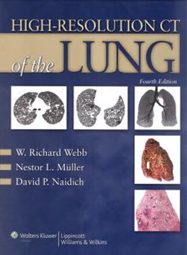 Imagem de HIGH-RESOLUTION CT OF LUNG - 4TH ED