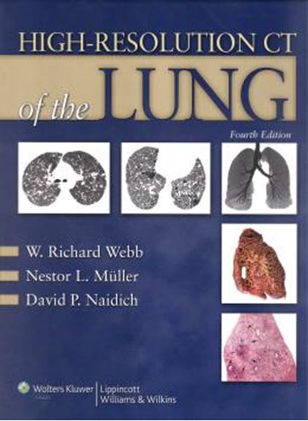 Picture of HIGH-RESOLUTION CT OF LUNG - 4TH ED