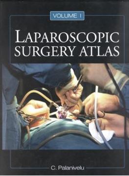 Imagem de LAPAROSCOPIC SURGERY ATLAS - 2 VOLS