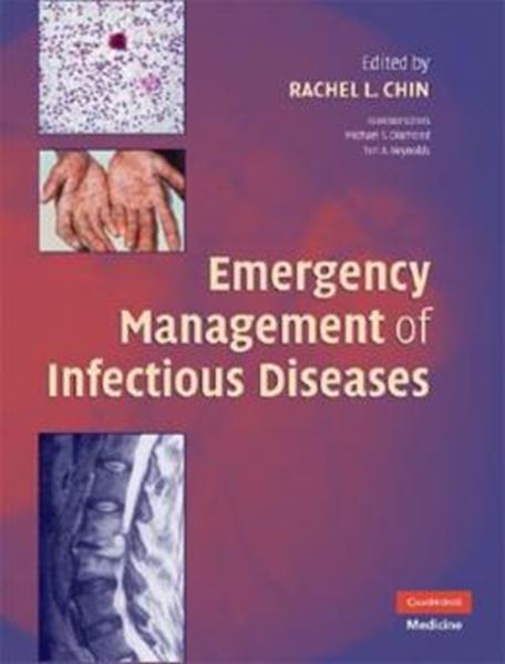 Picture of EMERGENCY MANAGEMENT OF INFECTIOUS DISEASES
