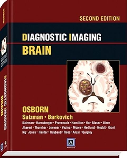 Picture of DIAGNOSTIC IMAGING: BRAIN - 2ND EDITION