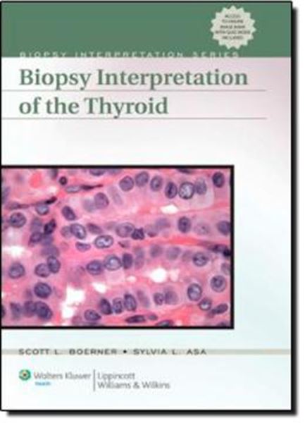 Picture of BIOPSY INTERPRETATION THYROID