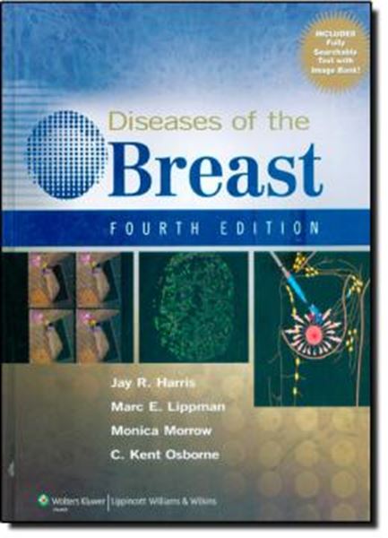 Picture of DISEASES OF THE BREAST - 4TH EDITION