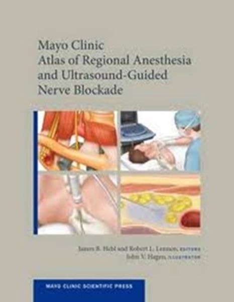 Picture of MAYO CLINIC ATLAS OF REGIONAL ANESTHESIA AND ULTRASOUND-GUIDED NERVE BLOCKADE