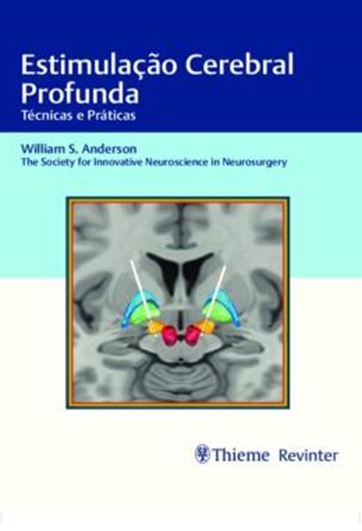 Picture of ESTIMULACAO CEREBRAL PROFUNDA - TECNICAS E PRATICAS