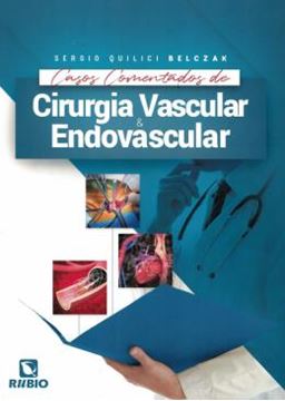 Imagem de CASOS COMENTADOS DE CIRURGIA VASCULAR E ENDOVASCULAR - 1ª ED.