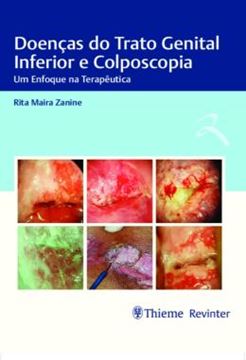 Imagem de DOENCAS DO TRATO GENITAL INFERIOR E COLPOSCOPIA - UM ENFOQUE NA TERAPEUTICA