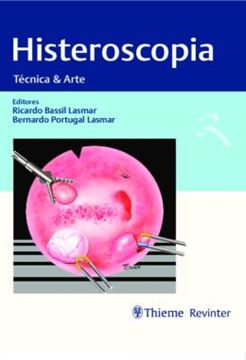 Imagem de HISTEROSCOPIA - TECNICA E ARTE