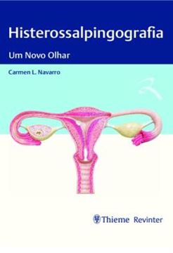 Imagem de HISTEROSSALPINGOGRAFIA - UM NOVO OLHAR