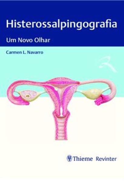 Picture of HISTEROSSALPINGOGRAFIA - UM NOVO OLHAR