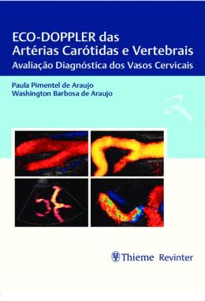 Picture of ECO-DOPPLER DAS ARTERIAS CAROTIDAS E VERTEBRAIS - AVALIACAO DIAGNOSTICA DOS VASOS CERVICAIS