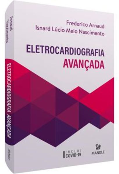 Picture of ELETROCARDIOGRAFIA AVANCADA