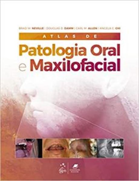 Picture of ATLAS DE PATOLOGIA ORAL E MAXILOFACIAL