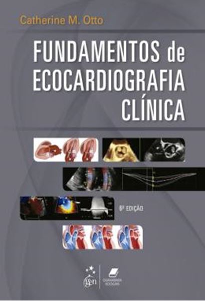 Picture of FUNDAMENTOS DE ECOCARDIOGRAFIA CLINICA