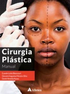 Imagem de CIRURGIA PLASTICA- MANUAL