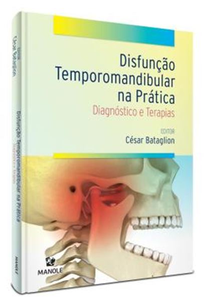Picture of DISFUNCAO TEMPOROMANDIBULAR NA PRATICA - DIAGNOSTICO E TERAPIAS