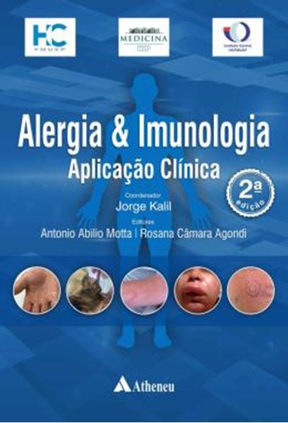 Picture of ALERGIA E IMUNOLOGIA  - APLICACAO CLINICA - 2ª ED
