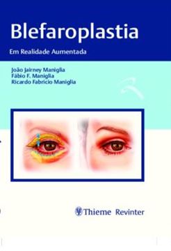 Imagem de BLEFAROPLASTIA - EM REALIDADE AUMENTADA