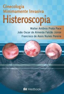 Imagem de HISTEROSCOPIA - GINECOLOGIA MINIMAMENTE INVASIVA