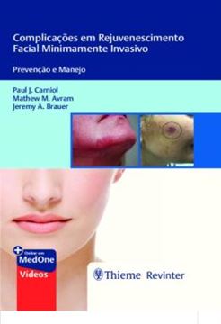Imagem de COMPLICACOES EM REJUVENESCIMENTO FACIAL MINIMAMENTE INVASIVO - PREVENCAO E MANEJO