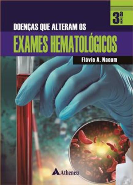 Picture of DOENCAS QUE ALTERAM OS EXAMES HEMATOLOGICOS - 3ª ED.