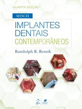 Imagem de MISCH - IMPLANTES DENTAIS CONTEMPORANEOS - 4ª ED