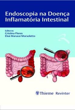 Imagem de ENDOSCOPIA NA DOENCA INFLAMATORIA INTESTINAL