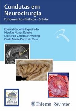 Imagem de CONDUTAS EM NEUROCIRURGIA - FUNDAMENTOS PRATICOS - CRANIO
