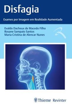 Imagem de DISFAGIA - EXAMES POR IMAGEM EM REALIDADE AUMENTADA