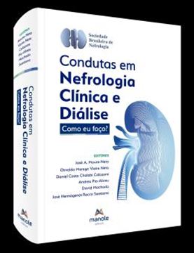 Imagem de CONDUTAS EM NEFROLOGIA CLINICA E DIALISE - 1ª ED