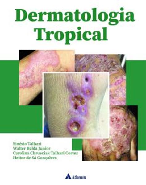 Picture of DERMATOLOGIA TROPICAL