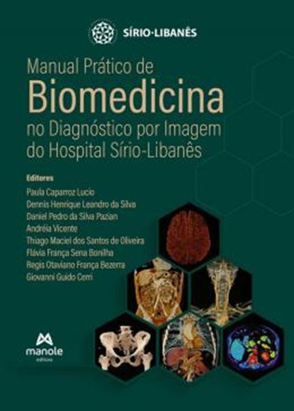 Picture of MANUAL PRATICO DE BIOMEDICINA NO DIAGNOSTICO POR IMAGEM DO HOSPITAL SIRIO-LIBANES