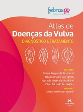 Imagem de ATLAS DE DOENCAS DA VULVA