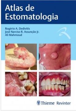 Imagem de ATLAS DE ESTOMATOLOGIA