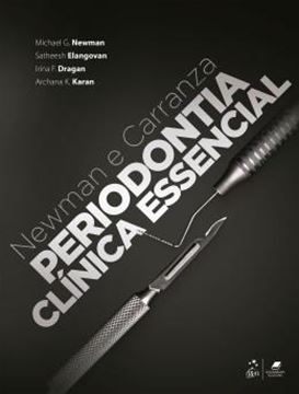 Imagem de NEWMAN E CARRANZA - PERIODONTIA CLINICA ESSENCIAL