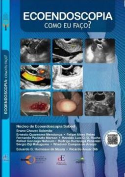 Imagem de ECOENDOSCOPIA COMO EU FACO?