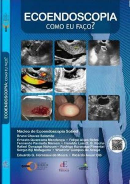 Picture of ECOENDOSCOPIA COMO EU FACO?