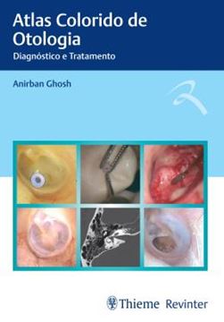 Imagem de ATLAS COLORIDO DE OTOLOGIA - DIAGNOSTICO E TRATAMENTO
