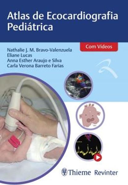 Picture of ATLAS DE ECOCARDIOGRAFIA PEDIÁTRICA