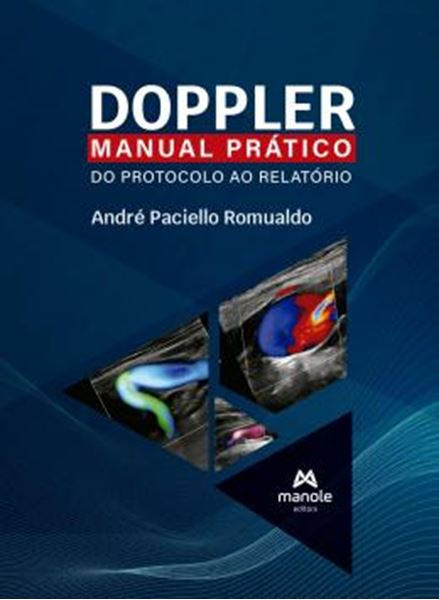 Picture of DOPPLER - MANUAL PRATICO DO PROTOCOLO AO RELATORIO