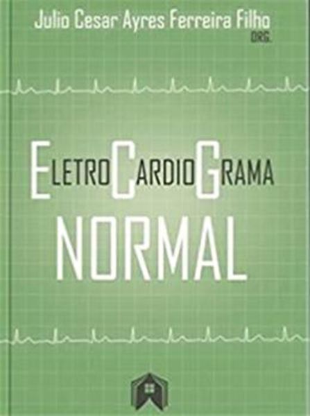 Picture of ELETROCARDIORAMA NORMAL