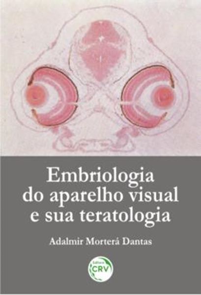 Picture of EMBRIOLOGIA DO APARELHO VISUAL E SUA TERATOLOGIA