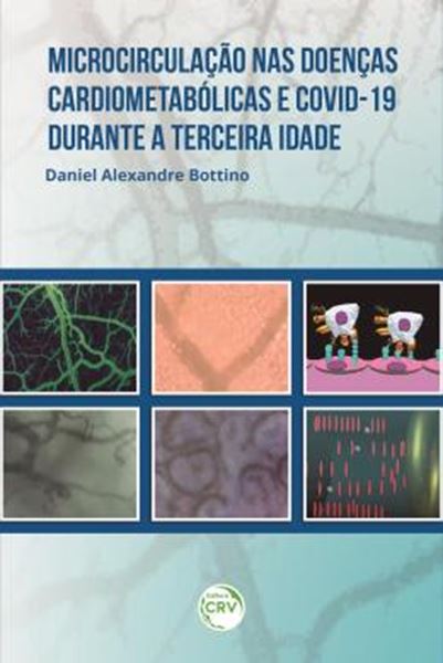 Picture of MICROCIRCULACAO NAS DOENCAS CARDIOMETABOLICAS E COVID-19 DURANTE A TERCEIRA IDADE