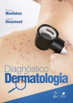 Imagem de DIAGNOSTICO EM DERMATOLOGIA - 1ª ED